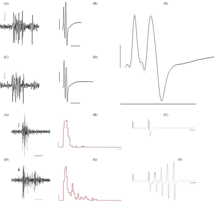 Figure 3. Top: reliability of the NSI procedure. ISMS triggered by the response of a Pr5 neuron to two 10 ms air-jet stimuli delivered to the same whisker (A) and (C) generate almost identical EMGs (B) and (D)
