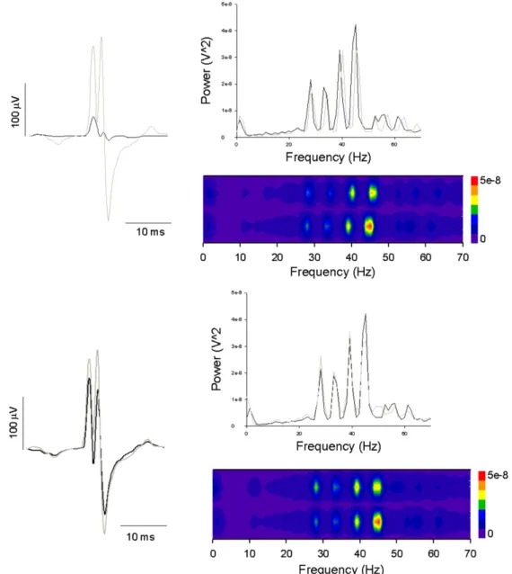 Figure 4. Top: mean EMGs obtained from the ISMS at two different depths of the spinal cord (left, gray and black line) using the same CNS neural pattern recordings (50 trials, 10 ms long stimuli delivered to the same vibrissa) and their power spectra (righ