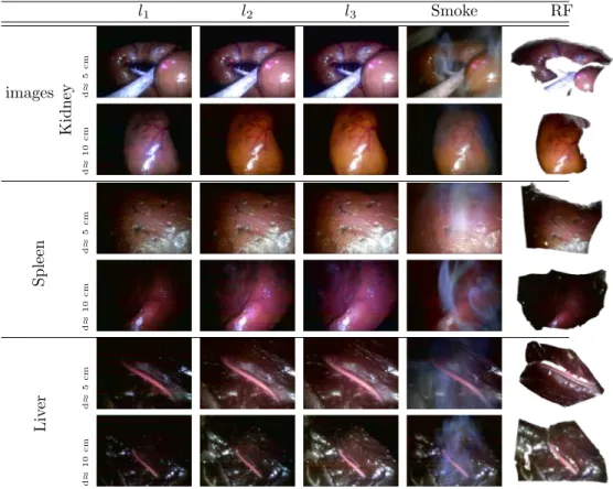 Figure 7: Example of endoscopic stereo dataset images. All the different condi- condi-tions are represented (distances, levels of light and smoke) for one pose of the spleen, kidney and liver.