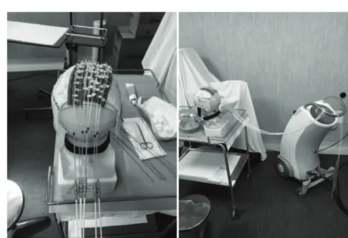 Fig. 3. – Picture of the mask ﬁxed on the skull of the phantom (left panel) and Flexitron with the source channels transported via catheter and ﬁxed on the mask (right panel).