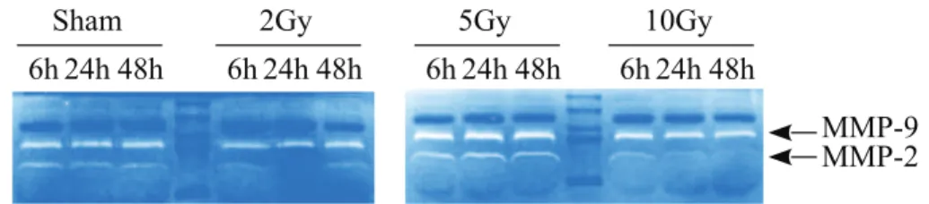 Fig. 1. – Representative images of gelatine zymography, performed for samples of the “Treat + Seed” method.