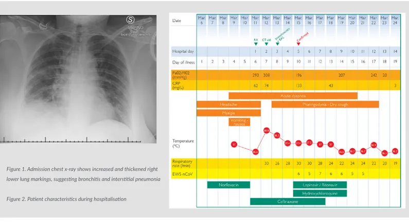 Figure 1. Admission chest x-ray shows increased and thickened right  lower lung markings, suggesting bronchitis and interstitial pneumonia Figure 2