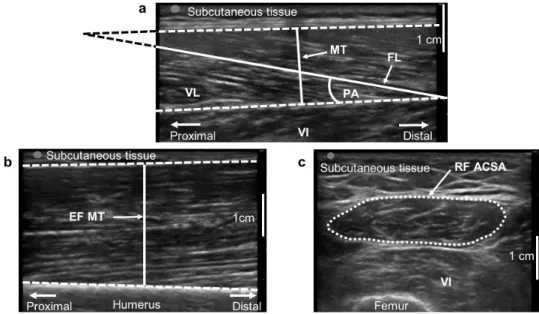 Figure 2. Ultrasound images analysis. Ultrasound images analysis for vastus lateralis (VL, 2a),  elbow flexors (EF, 2b) and rectus femoris (RF, 2c) muscles