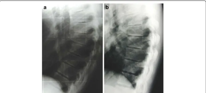 Fig. 3 The figure shows a case at beginning of treatment (a) and at follow-up (b)
