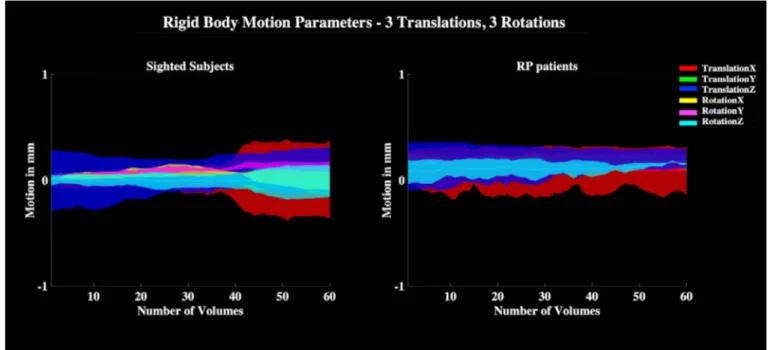 Figure 3. Motion parameters. Rigid body motion parameters (in mm, three translations and three rotations) as a function of the number of volumes included in the EPI time series for the sighted (left) and RP (right) group