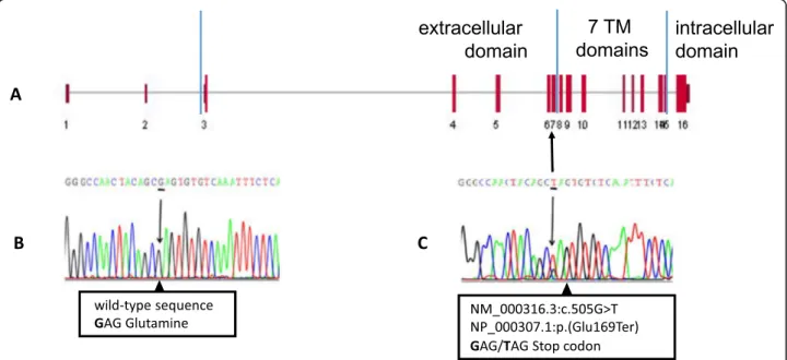 Fig. 4 Localization on exon 7 of the nonsense PTH1R variant identified in our PFE patient (a), nucleotide sequence of a normal individual (b), sequence variant of proband III-1 (c) with the heterozygous variant G &gt; T shown as a double peak in the electr