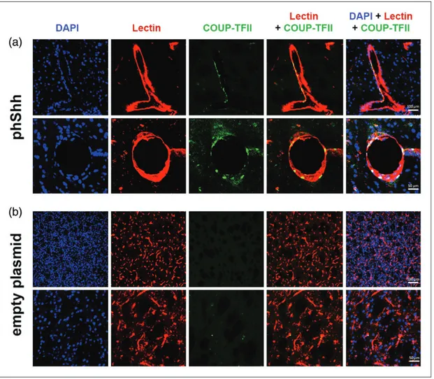 Figure 7. Expression of COUP-TFII in phShh-induced brain neovessels. Sections of brain hemispheres injected with phShh and empty plasmid were stained for DAPI (blue staining) to identify cell nuclei, lectin (red staining) to identify blood vessels, and  CO