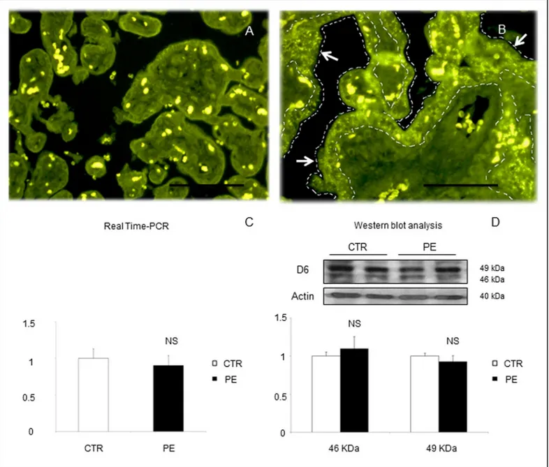 Fig 1. Representative images of immunofluorescent staining for D6 in placental sections from (A) a normal pregnant woman at term or (B) a woman with PE at 28 weeks of gestation