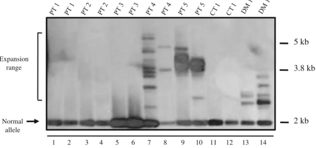 Fig. 1 LR-PCR/Southern blot. For each sample, reactions were performed in duplicate: lanes 1–6 = pts 1–3; lanes 7–10 = pts 4–5;