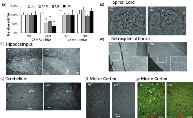Figure 2. Confirmation of CRMP2 reduction in cKO mice. (a) qPCR for CRMP2 and CRMP1 mRNAs in spinal cord (SC), cortex (CTX), cerebellum (CB), and hippocampus (HC) of WT and cKO mice 2 weeks after treatment with tamoxifen