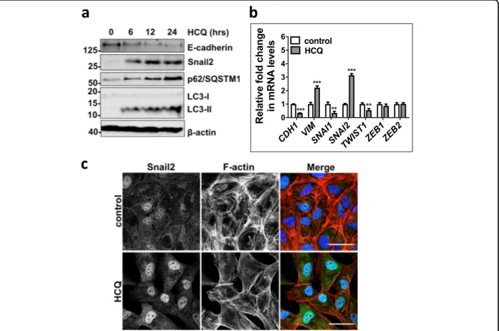 Fig. 2 Autophagic activity altered by chemicals affects cellular plasticity of ATII cells