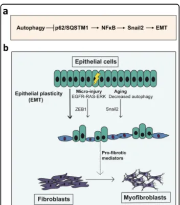 Fig. 6 Autophagy inhibition-mediated epithelial –mesenchymal transition augments local myo ﬁbroblast differentiation in pulmonary ﬁbrosis