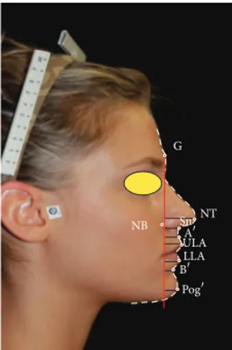 Figure 1: “Vertical Planning Line” analysis on a participant to “Miss Italia 2011.”