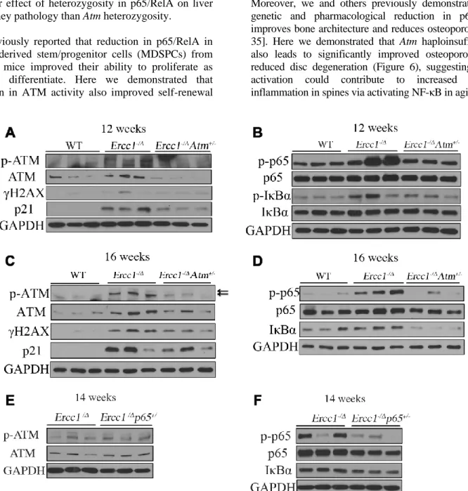 Figure 7. ATM and NF-κB activation are downregulated in  Ercc1 -/Δ  mice heterozygous for  Atm