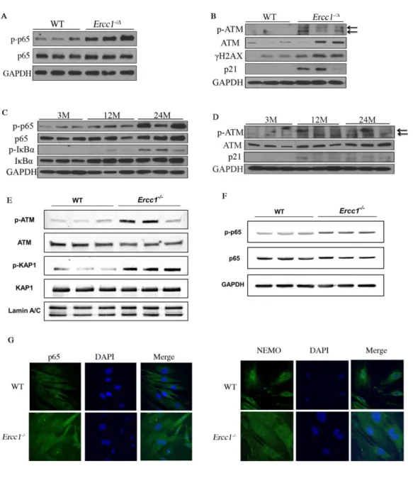 Figure 1. DDR and NF-κB are activated concomitantly in senescent MEFs and aged tissues