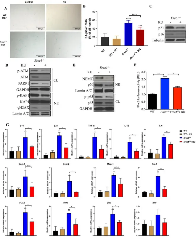 Figure  2.  Pharmacologic  inhibition  of  ATM  rescues  oxidative  stress-induced  senescence  by  suppressing  ATM-  and  NEMO- NEMO-mediated  NF-κB  activation