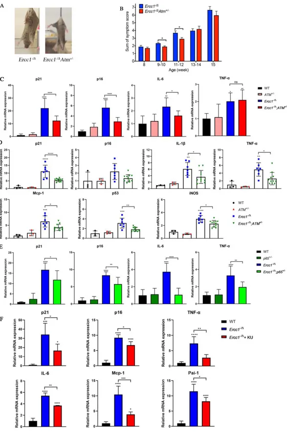 Figure 4. Genetic reduction of Atm attenuates aging phenotypes and reduces cellular senescence in vivo