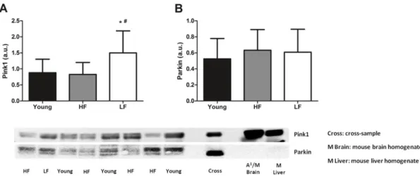 Figure 5. Protein levels of selected markers of mitophagy in the vastus lateralis muscle of young and  old participants