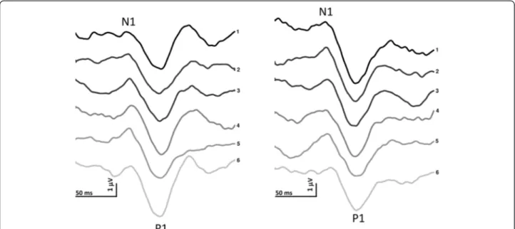 Fig. 2 Representative recordings of visual evoked potentials in a migraine patient recorded before (left panel) and after a 1-month (right panel) ketogenic diet