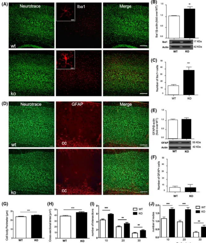 FIGURE 4  DHA deficiency alters microglia response without affecting astrogliosis. A, Immunofluorescence staining of microglia (Iba1) in  the cerebral cortex of WT and KO mice