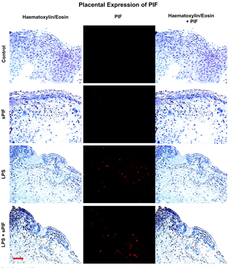 Fig 2. Placental PIF expression. Images of representative placental section (we evaluated 3 consecutive placental sections from 8–10 mice per group) stained using hematoxylin and eosin (left panels) and examined the presence of PIF by specific anti-PIF ant