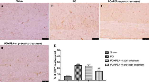 Figure 3. Effects of PEA-m on levels of nerve growth factor (NGF). Immunohistochemical analysis  showed no staining for NGF in the sham group (A)