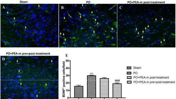 Figure 5. Effects of PEA-m on brain-derived neurotrophic factor (BDNF) expression in lumbar spinal  cord after PO