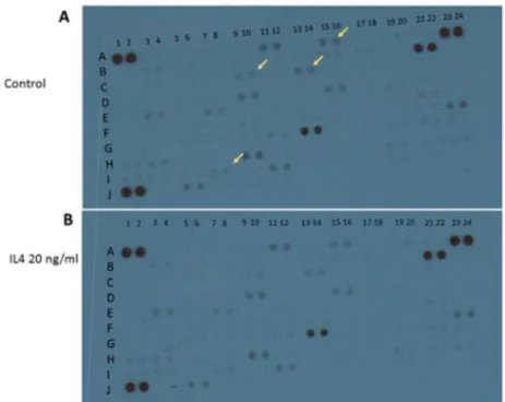 Figure 6. Effects of the human recombinant interleukin 4 (IL4) and human recombinant interleukin  13 (IL13) on urea release