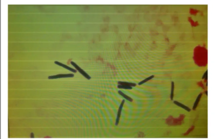 FIGURE 3 | Microscopic morphology of Saprochaete clavata in positive blood cultures showing yeast-like cells.