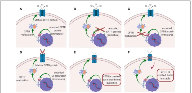 FIGURE 1 | Schematic representation of the mutations on CFTR leading to CF disease: (A) CFTR works normally (no mutations); (B) Class I and VII mutation; (C) Class II mutations; (D) classes III and IV mutations; (E) Class V mutation; (F) class VI mutations