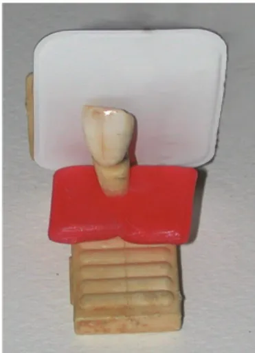 Figure 1: Extracted tooth on the endooral centering support.