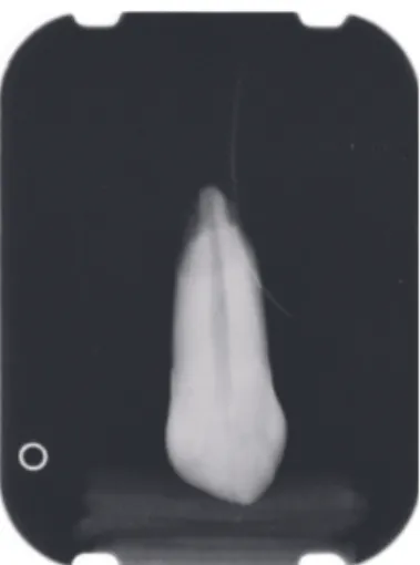 Figure 2: Simulated dental arch made of orthodontic resin, methacrylic orthocryl: occlusal vision.