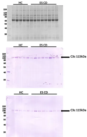 Fig. 6 – Immunoblotting of the C3c. (a) One dimensional electrophoresis (coomassie staining)