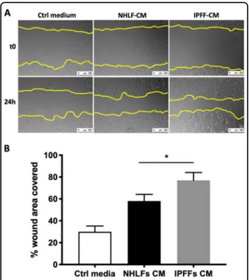 Fig. 1 The effect of ﬁbroblast conditioned media on repair of primary AEC monolayers following a scratch wound.