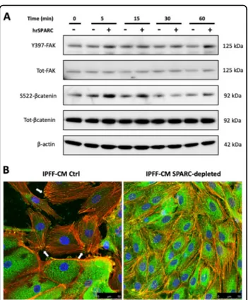 Fig. 5 The effect of SPARC depletion from IPFF-CM on epithelial adhesion junctions. a H441 lung epithelial cells were treated with IPFF-CM control (Ctrl) or IPFF-CM SPARC-depleted; cells were then ﬁxed and stained for TJs or AJs and imaged using epiﬂuoresc