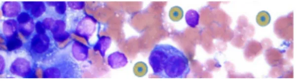 Figure 3. Liposomes internalization into melanoma cells. 