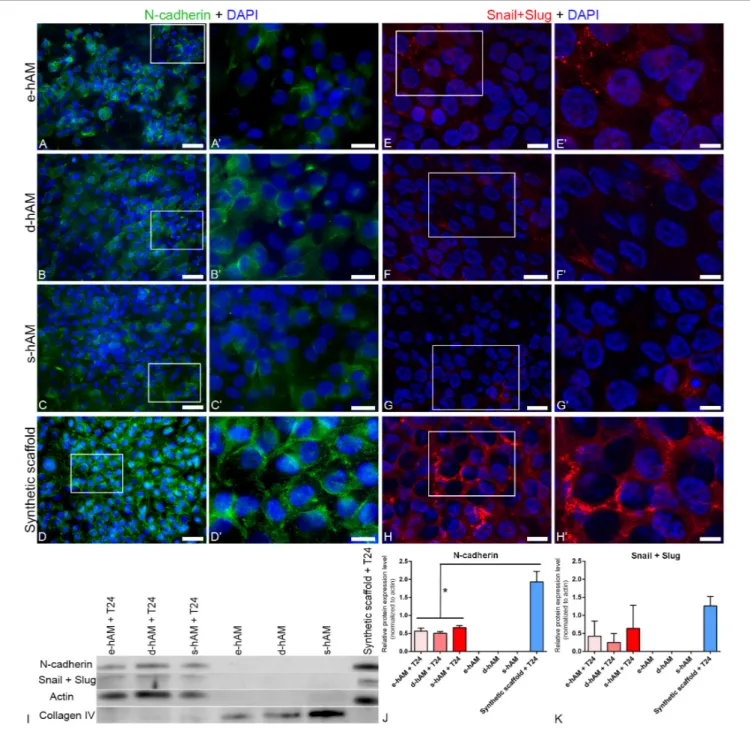 FIGURE 5 | hAM scaffolds affect the expression of N-cadherin and Snail+Slug in T24 cells