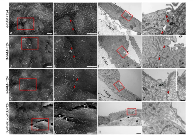 FIGURE 7 | Ultrastructure of T24 cells on hAM and synthetic scaffolds. Scanning (A–D’) and transmission (E–H’) electron microscopy images are represented