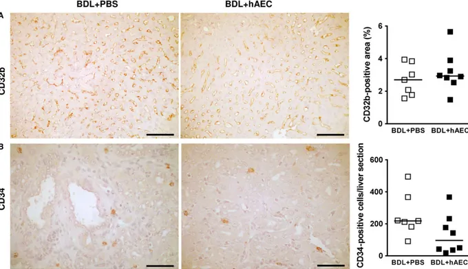 Fig. 6 hAEC treatment does not act on liver sinusoidal endothelial cell defenestration