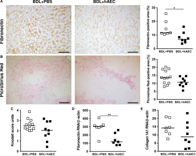 Fig. 2 hAEC treatment reduces extracellular matrix deposition. Livers extracted from control (BDL + PBS) and treated (BDL + hAEC) rats, 6 weeks after bile duct ligation (BDL), were evaluated for extracellular matrix protein (fibronectin and collagen) depos