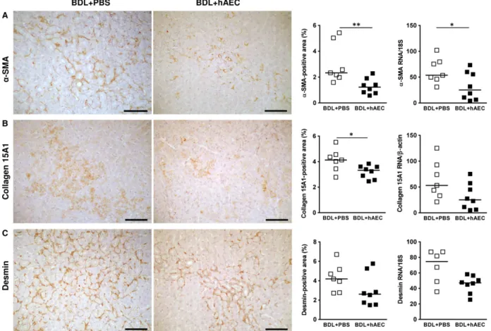 Fig. 3 hAEC treatment decreases hepatic fibroblast activation. Immunohistochemical and quantitative image analysis of rat liver sections from control (BDL + PBS) and treated (BDL + hAEC) rats, 6 weeks after BDL