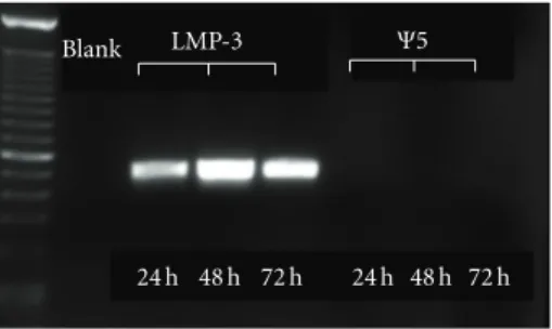 Figure 1: Transduction eﬃciency. RT-PCR showing transgenic LMP-3 expression (visible bands) up to 72 hours after cell transduction