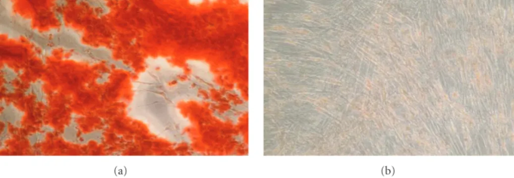Figure 2: Osteogenic diﬀerentiation in vitro. Alizarin Red staining performed 2 weeks after cell transduction, showing a red-colored mineralized matrix in treated cells ((a) AdLMP-3) and negative staining in control cells ((b) AdΨ5).