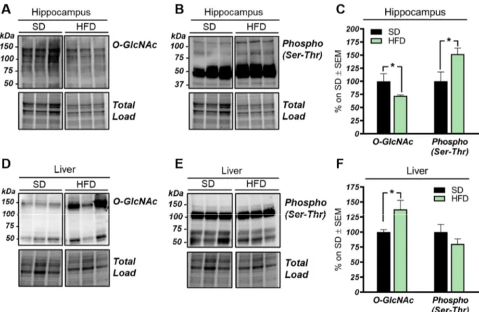 Figure 1. O-GlcNAcylation and phosphorylation profile in the hippocampus and liver from high-fat diet (HFD) mice