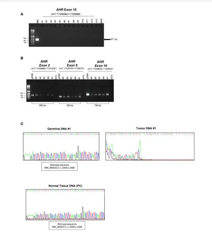 FIGURE 1 | Characterization of somatic aryl hydrocarbon receptor (AHR) mutation in Growth Hormone (GH)-secreting pituitary tumors