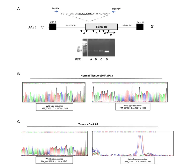 FIGURE 2 | Validation of in frame somatic deletion on tumor DNA. (A) Schematic image of the human aryl hydrocarbon receptor (AHR) gene structure and localization of in frame deletion