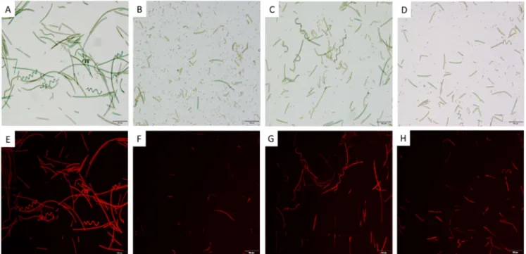 Fig. 6. Images of optical (A, B, C, D) and ﬂuorescence (E, F, G, H) microscopy (100X) of untreated (A, E), freeze-thawing treated (B, F), conventional thermal treated (C, G) and OH treated (D, H) cells of Spirulina platensis