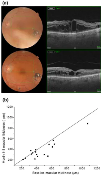 Fig. 1 a Fundus image and macular OCT of a patient showing improvement in CMT after FAc intravitreal implant