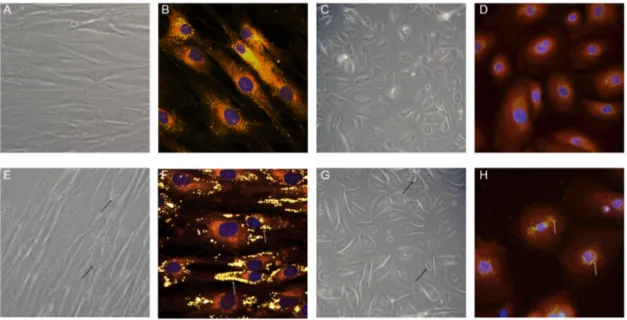 Figure 6. LD images obtained from NLSDI skin cells. Phase-contrast images of cultured fibroblasts  and keratinocytes from control (A,C) and affected subjects (E,G); fluorescent  microscopy images  with Nile Red and DAPI staining of fibroblasts and keratino