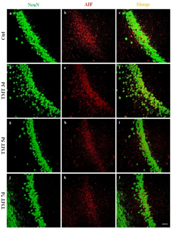 Figure 6. Apoptosis-Inducing Factor (AIF) immunofluorescence labeling in the rat hippocampus after TMT treatment is not localized in the neuron nuclei